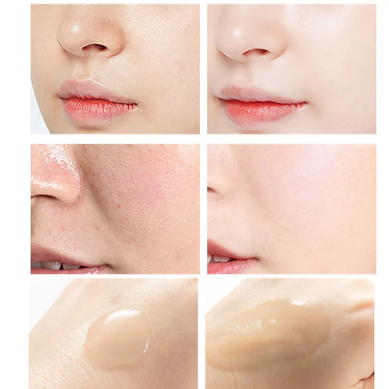 Siero Peeling acido salicilico - Niacinamide Pore Shrinking Essence recensione e prezzo