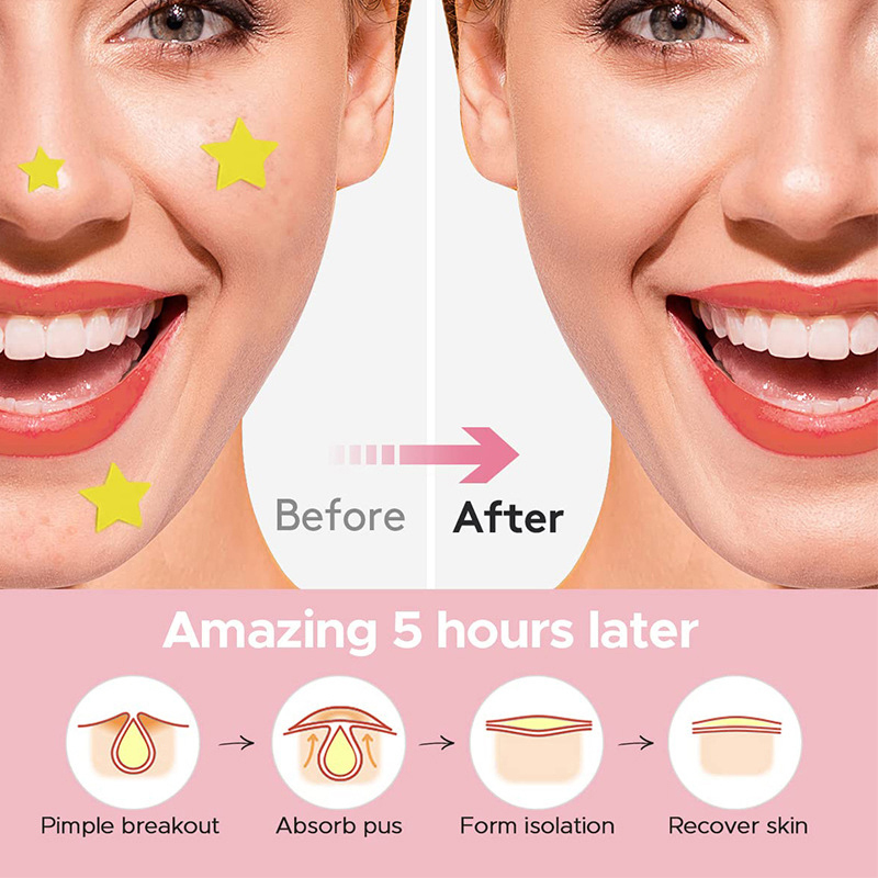 Set da 600 Pezzi di Cerotti pe - Skincare recensione e prezzo